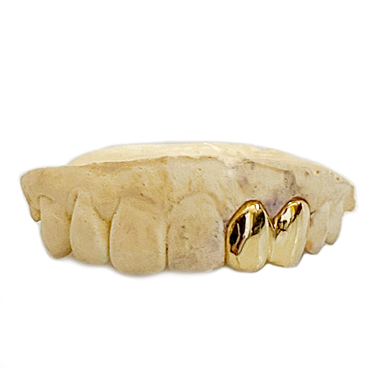 Custom gold newest teeth