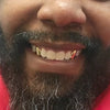 Gold Plated over 925 Sterling Silver Custom Canine Caps Teeth Grillz