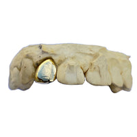 Real 18K Solid Gold Single Cap Custom Grillz (Choose Any Tooth)