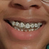 Real 925 Sterling Silver Custom Grillz Diamond Dust Starburst Cuts Teeth Grill