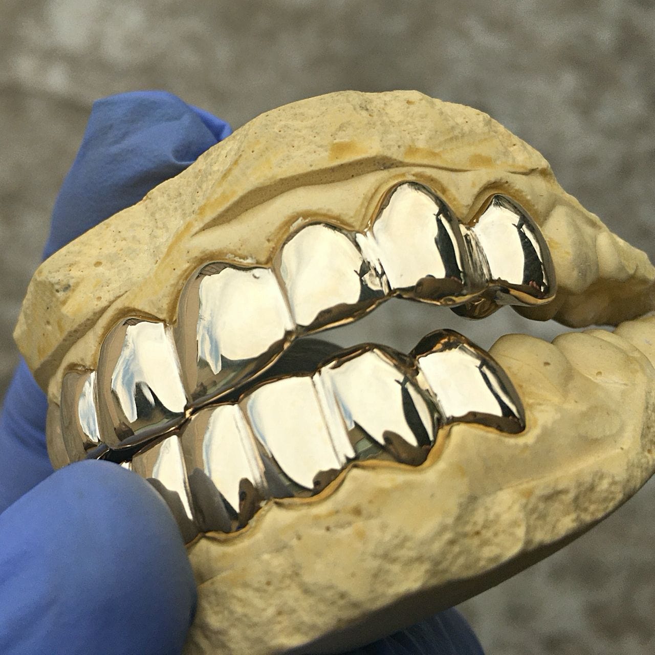 Custom Grillz: Real Solid 10K Gold Teeth