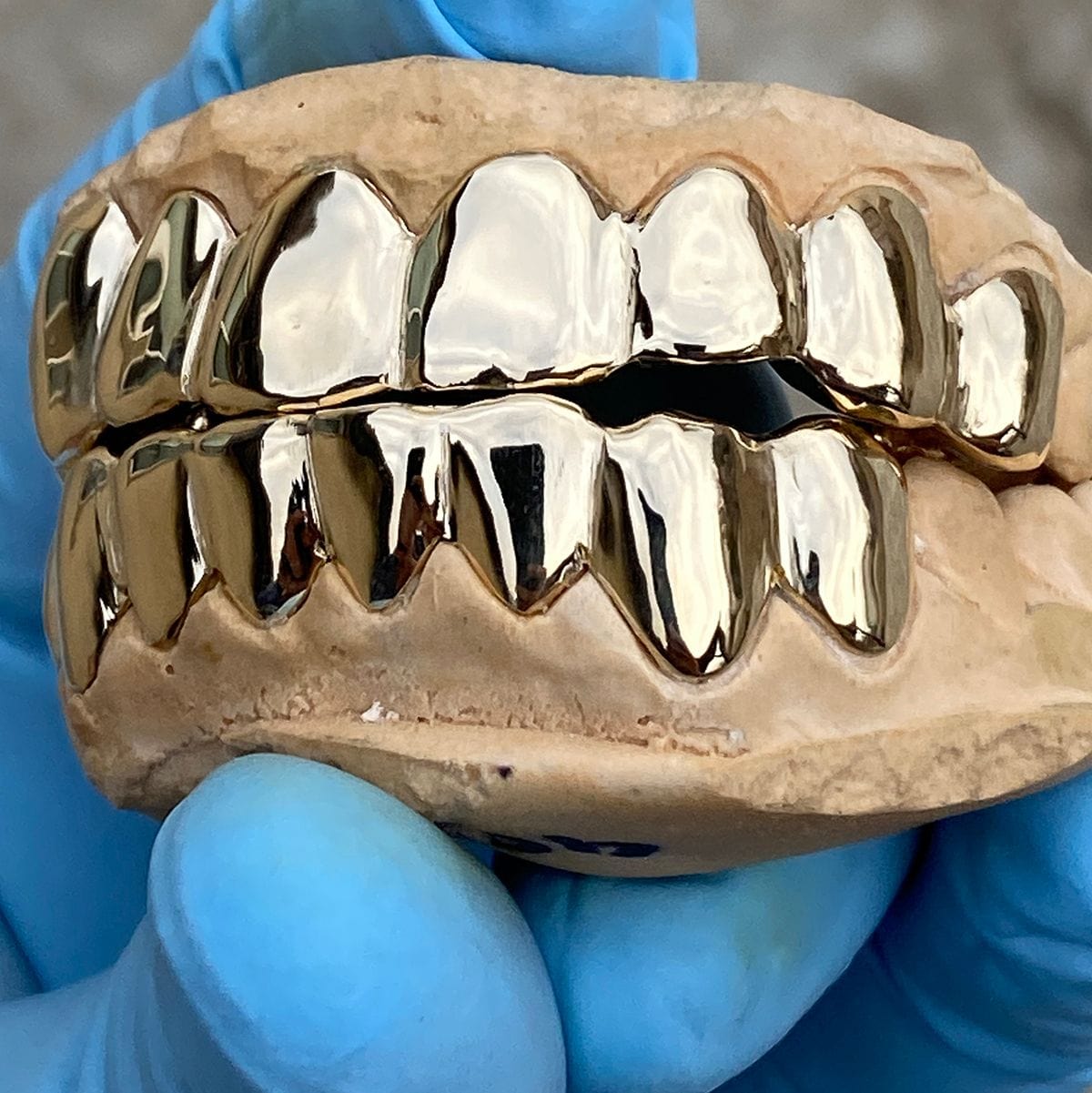 Custom Grillz: Real Solid 10K Gold Teeth