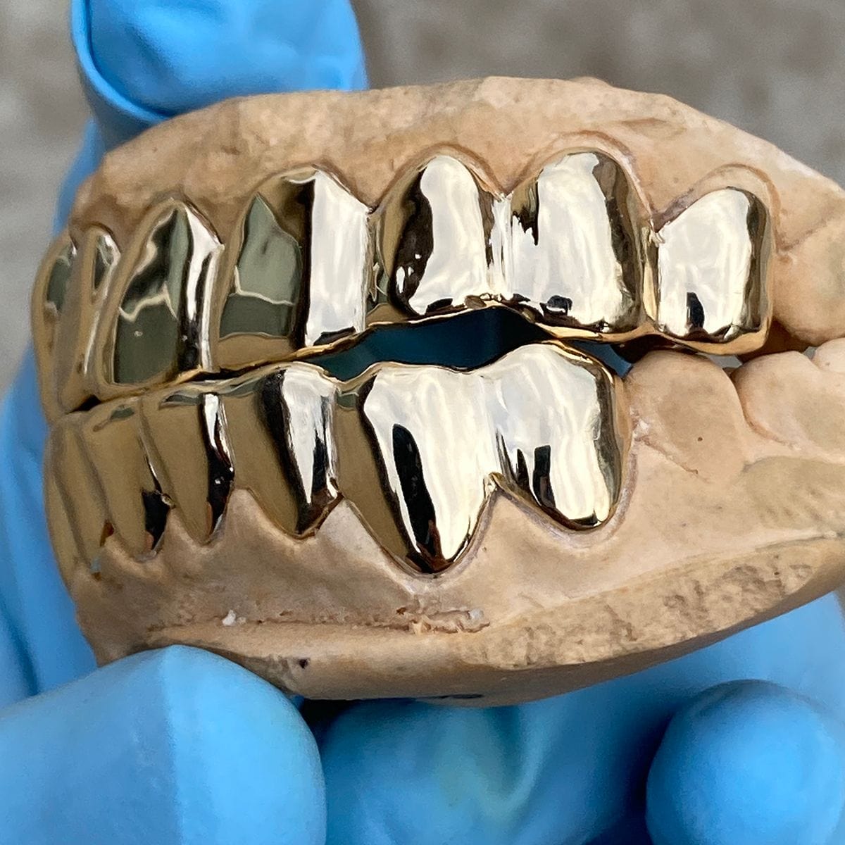 Custom Grillz: Real Solid 10K Gold Teeth