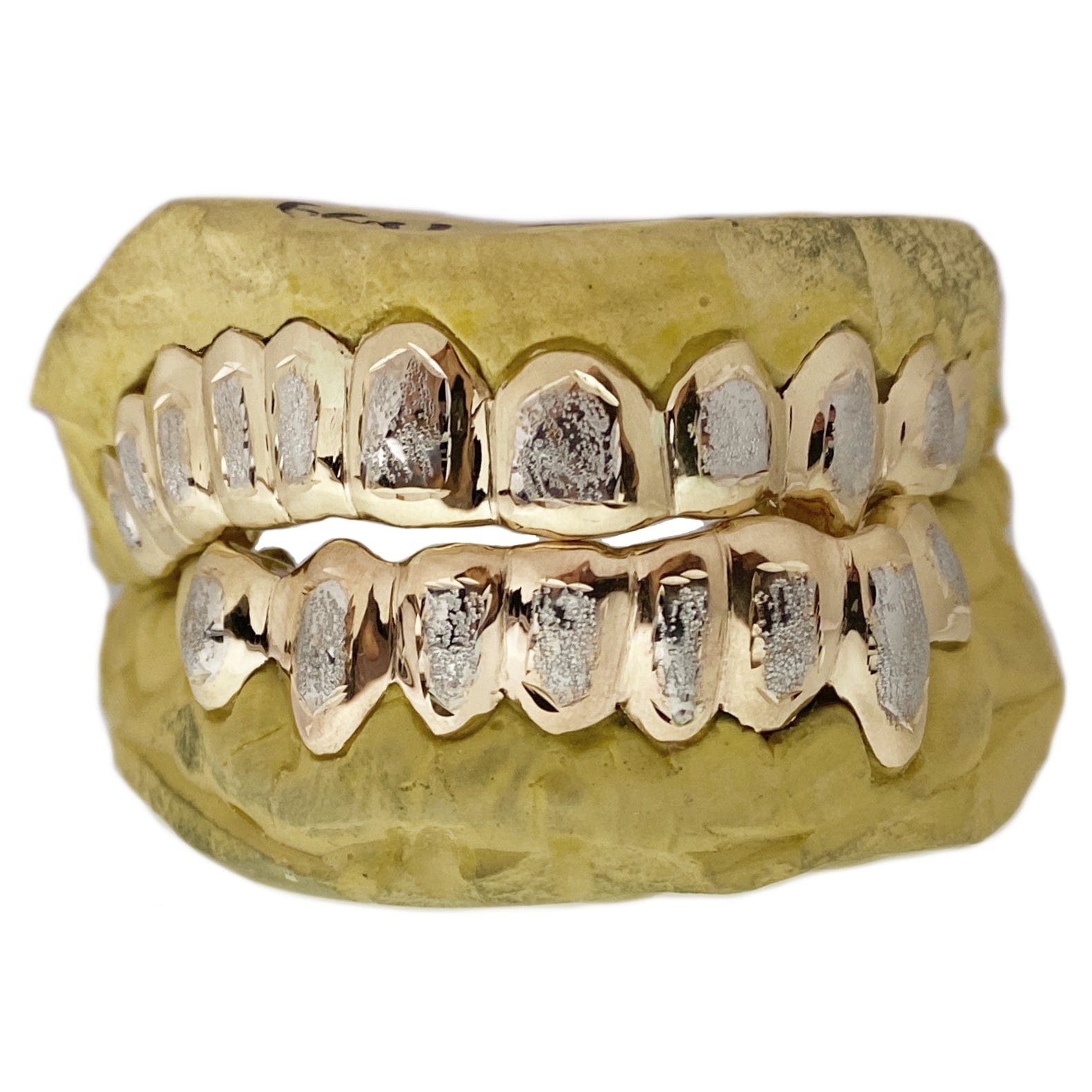 DIAMOND DUST EFFECT ON GOLD GRILLZ (#GoldGrillz) 